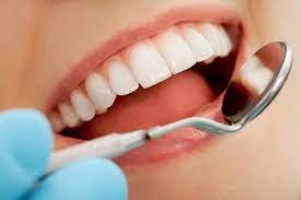 Teeth Whitening Service
