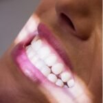 dentures in Bradenton